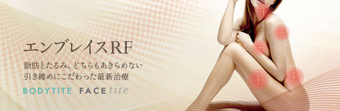 エンブレイス